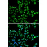 Immunofluorescence - Anti-Lamin B2 Antibody (A15247) - Antibodies.com