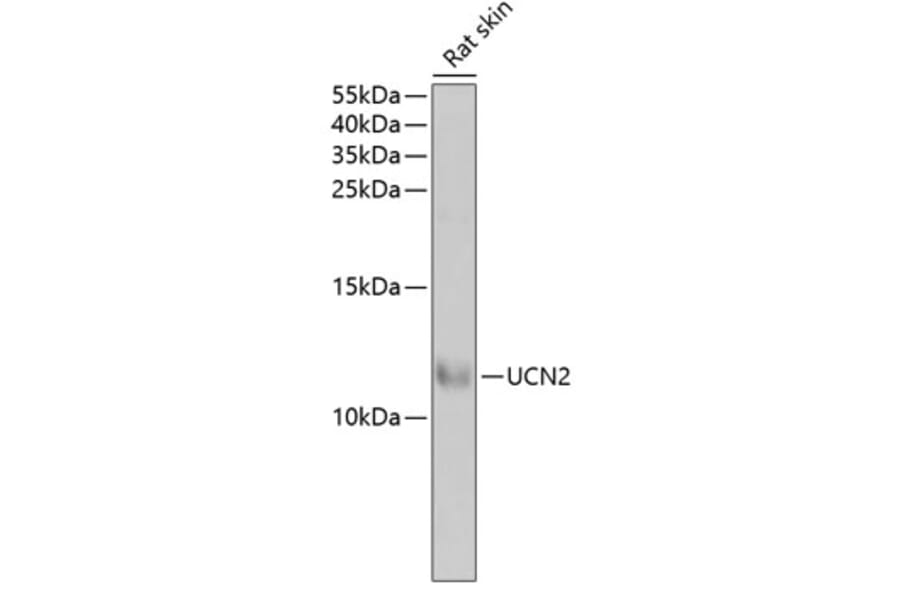 Western Blot - Anti-UCN2/SRP Antibody (A15248) - Antibodies.com