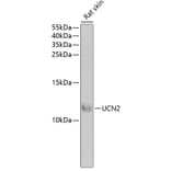 Western Blot - Anti-UCN2/SRP Antibody (A15248) - Antibodies.com