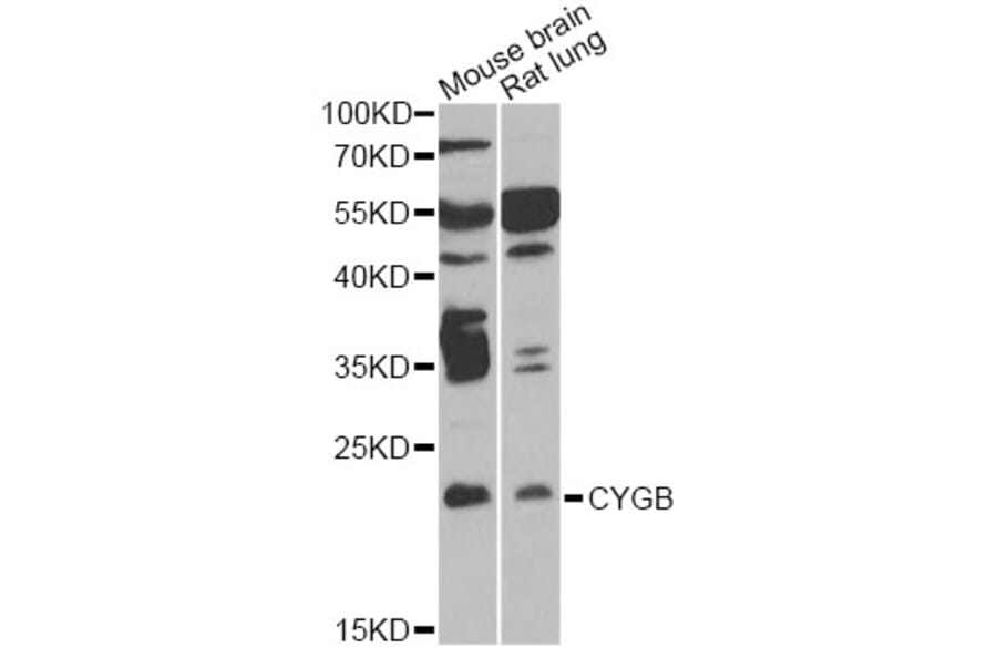 Western Blot - Anti-CYGB Antibody (A6488) - Antibodies.com