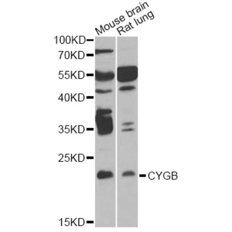 Western Blot - Anti-CYGB Antibody (A6488) - Antibodies.com