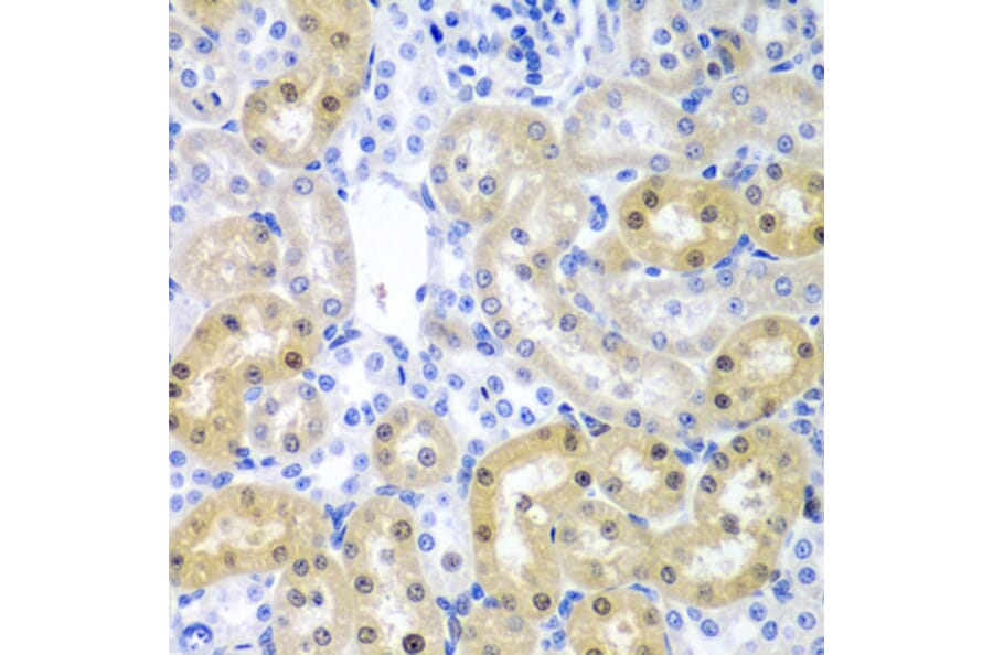 Immunohistochemistry - Anti-ADAD1 Antibody (A6491) - Antibodies.com