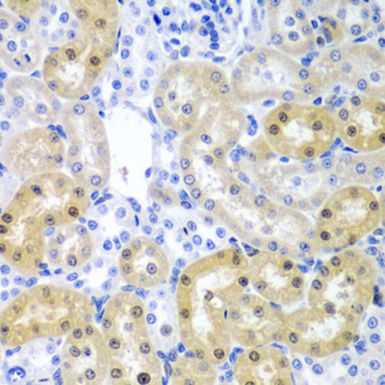 Immunohistochemistry - Anti-ADAD1 Antibody (A6491) - Antibodies.com