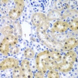 Immunohistochemistry - Anti-ADAD1 Antibody (A6491) - Antibodies.com