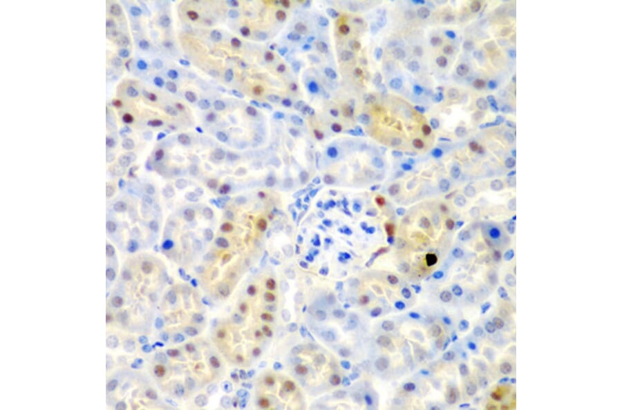 Immunohistochemistry - Anti-ADAD1 Antibody (A6491) - Antibodies.com