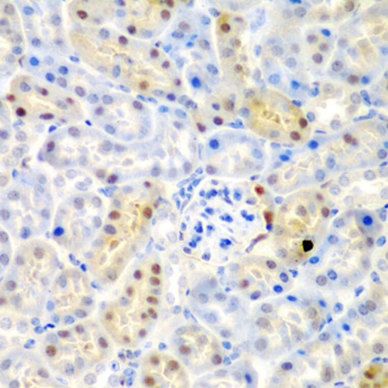 Immunohistochemistry - Anti-ADAD1 Antibody (A6491) - Antibodies.com