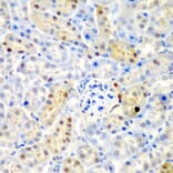 Immunohistochemistry - Anti-ADAD1 Antibody (A6491) - Antibodies.com