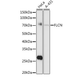 Western Blot - Anti-FLCN Antibody (A15251) - Antibodies.com