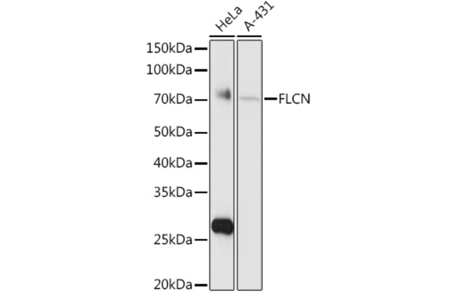 Western Blot - Anti-FLCN Antibody (A15251) - Antibodies.com