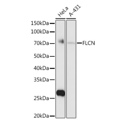 Western Blot - Anti-FLCN Antibody (A15251) - Antibodies.com