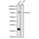 Western Blot - Anti-FLCN Antibody (A15251) - Antibodies.com