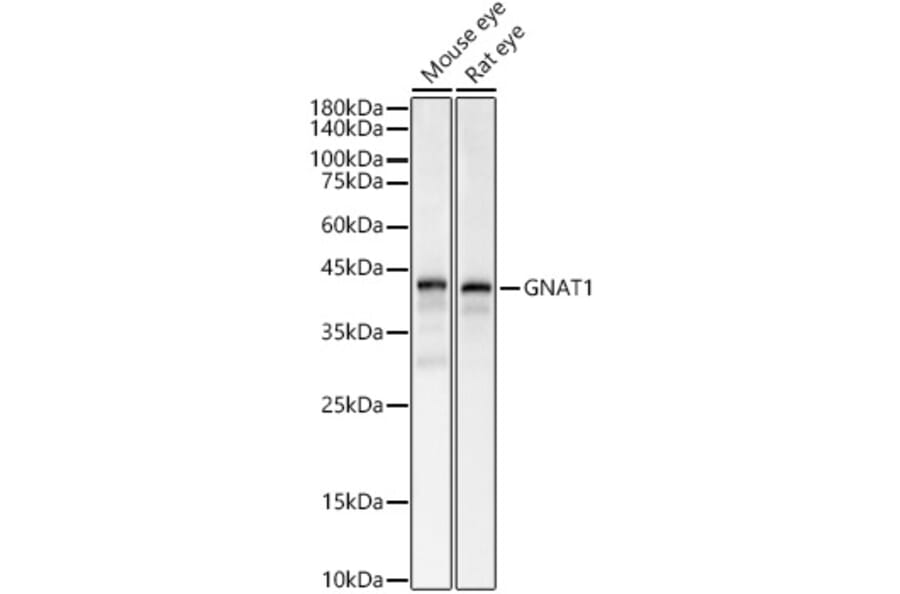 Western Blot - Anti-GNAT1 Antibody (A15252) - Antibodies.com