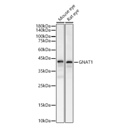 Western Blot - Anti-GNAT1 Antibody (A15252) - Antibodies.com