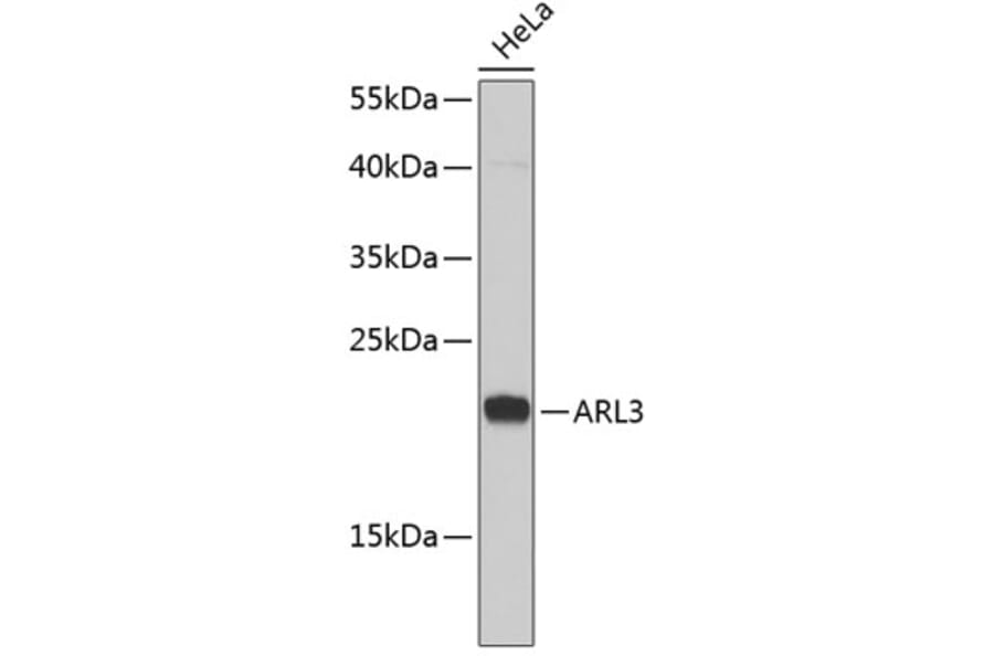 Western Blot - Anti-ARL3 Antibody (A6499) - Antibodies.com
