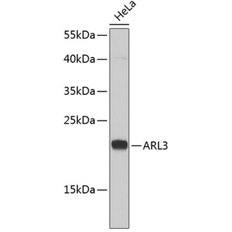 Western Blot - Anti-ARL3 Antibody (A6499) - Antibodies.com