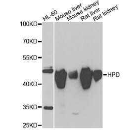 Western Blot - Anti-HPD Antibody (A15254) - Antibodies.com