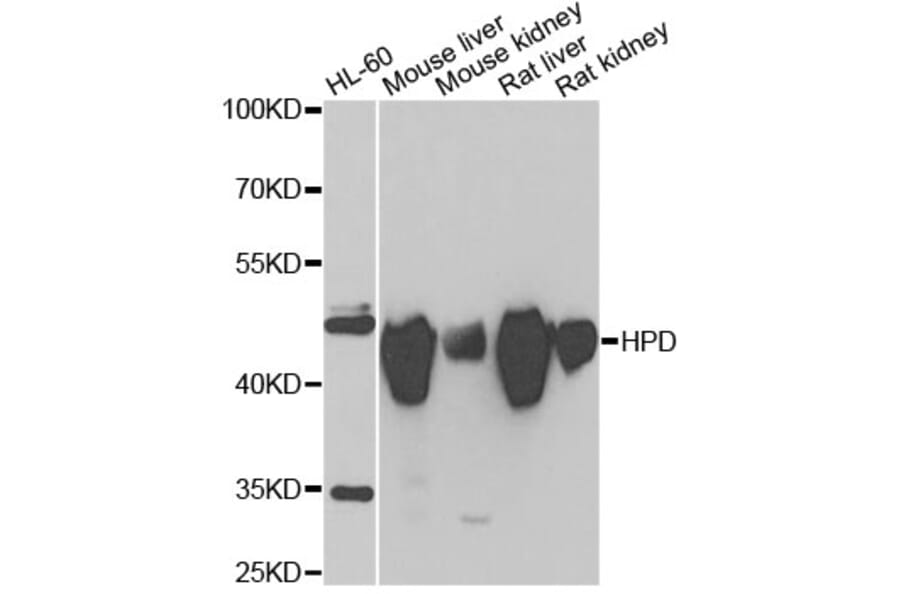 Western Blot - Anti-HPD Antibody (A15254) - Antibodies.com