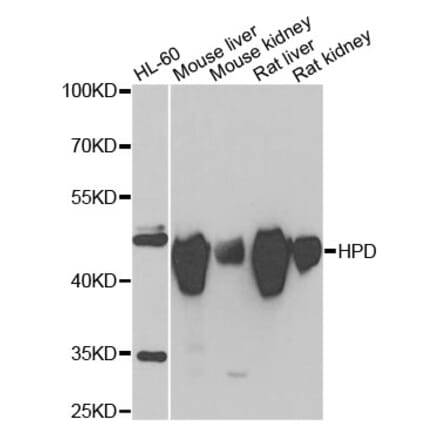 Western Blot - Anti-HPD Antibody (A15254) - Antibodies.com