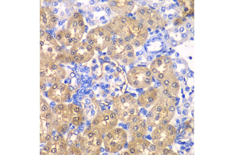 Immunohistochemistry - Anti-HPD Antibody (A15254) - Antibodies.com
