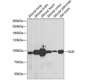Western Blot - Anti-Gli2 Antibody (A15256) - Antibodies.com