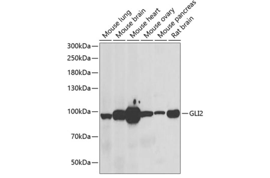 Western Blot - Anti-Gli2 Antibody (A15256) - Antibodies.com
