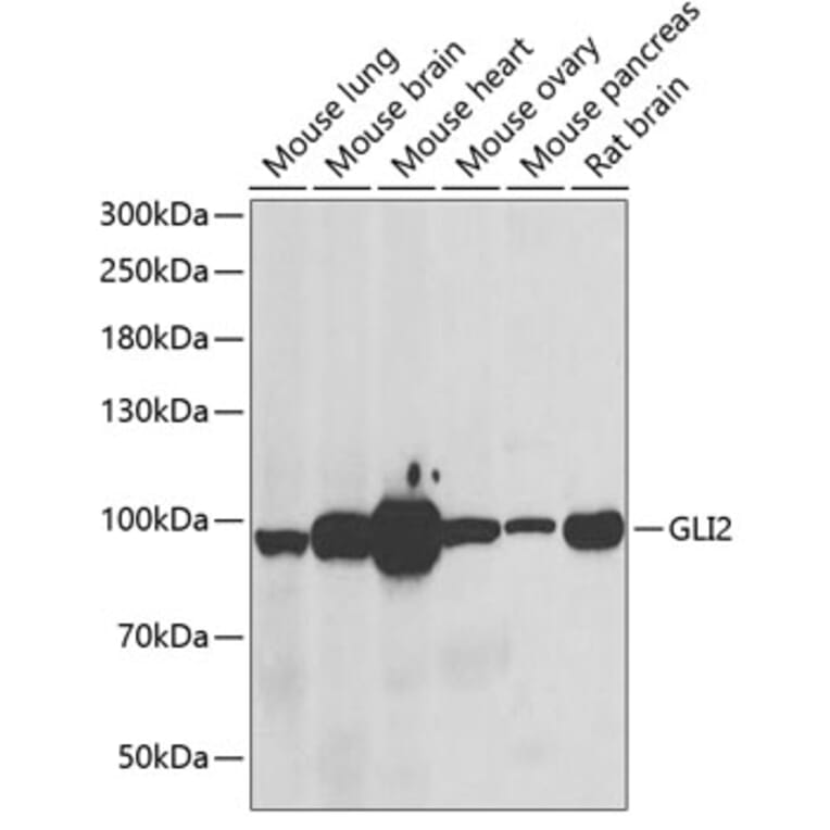 Western Blot - Anti-Gli2 Antibody (A15256) - Antibodies.com
