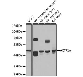 Western Blot - Anti-ACTR1A Antibody (A15257) - Antibodies.com