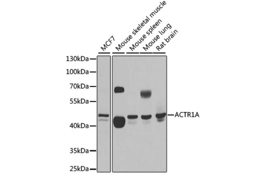 Western Blot - Anti-ACTR1A Antibody (A15257) - Antibodies.com