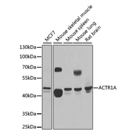 Western Blot - Anti-ACTR1A Antibody (A15257) - Antibodies.com