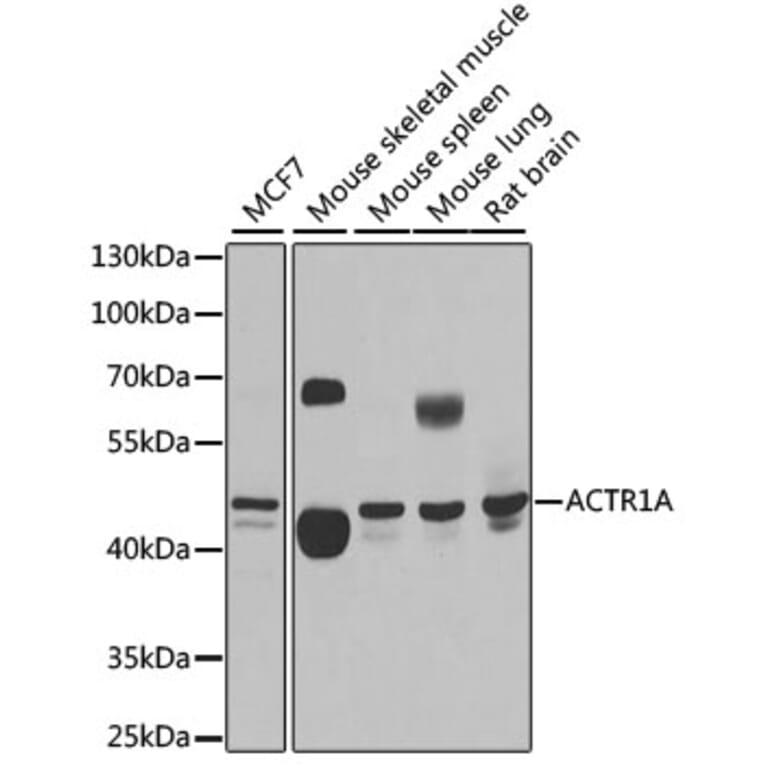 Western Blot - Anti-ACTR1A Antibody (A15257) - Antibodies.com