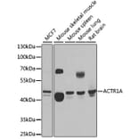 Western Blot - Anti-ACTR1A Antibody (A15257) - Antibodies.com