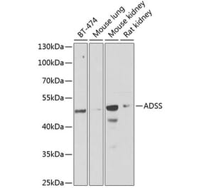 Western Blot - Anti-AdSS 2 Antibody (A15258) - Antibodies.com