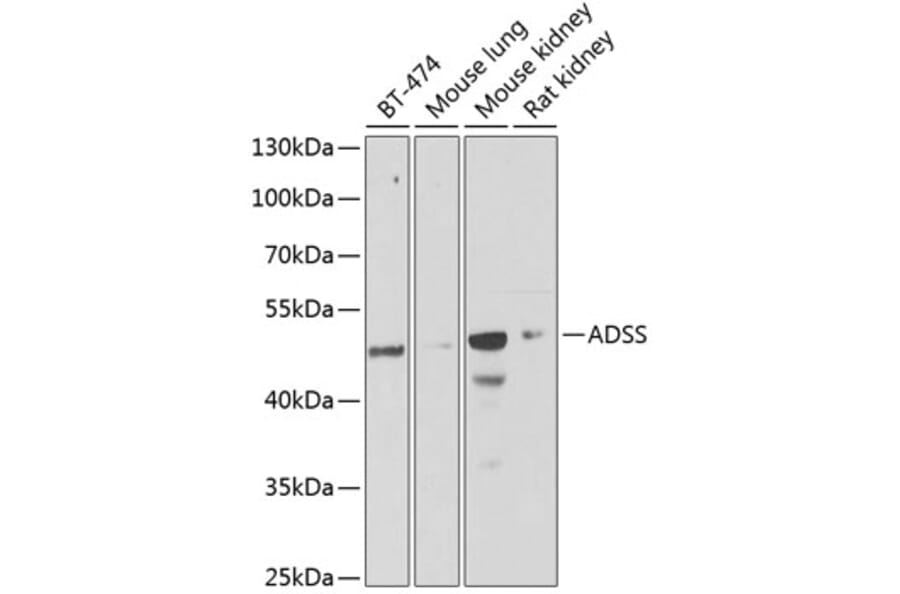 Western Blot - Anti-AdSS 2 Antibody (A15258) - Antibodies.com
