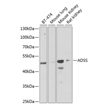 Western Blot - Anti-AdSS 2 Antibody (A15258) - Antibodies.com