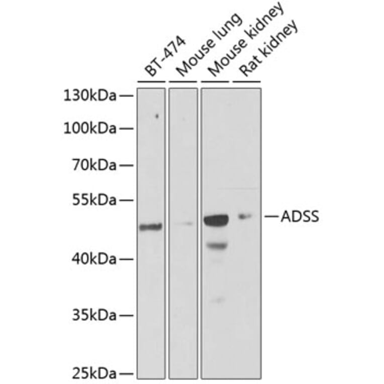 Western Blot - Anti-AdSS 2 Antibody (A15258) - Antibodies.com