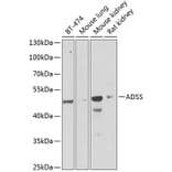 Western Blot - Anti-AdSS 2 Antibody (A15258) - Antibodies.com