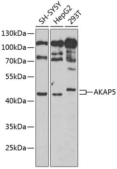 Western blot analysis of extracts of various cell lines, using Anti-AKAP5 Antibody (A6520) at 1:1,000 dilution.
Secondary antibody: Goat Anti-Rabbit IgG (H+L) (HRP) (AS014) at 1:10,000 dilution.
Lysates / proteins: 25µg per lane.
Blocking buffer: 3% non-fat dry milk in TBST.
Detection: ECL Basic Kit (RM00020).
Exposure time: 90s.