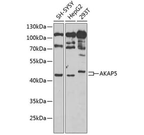 Western Blot - Anti-AKAP5 Antibody (A15259) - Antibodies.com