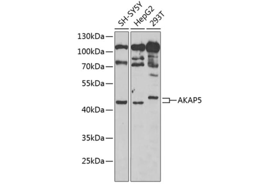 Western Blot - Anti-AKAP5 Antibody (A15259) - Antibodies.com