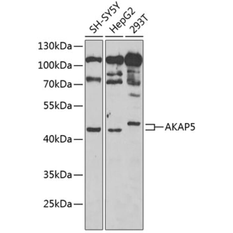 Western Blot - Anti-AKAP5 Antibody (A15259) - Antibodies.com