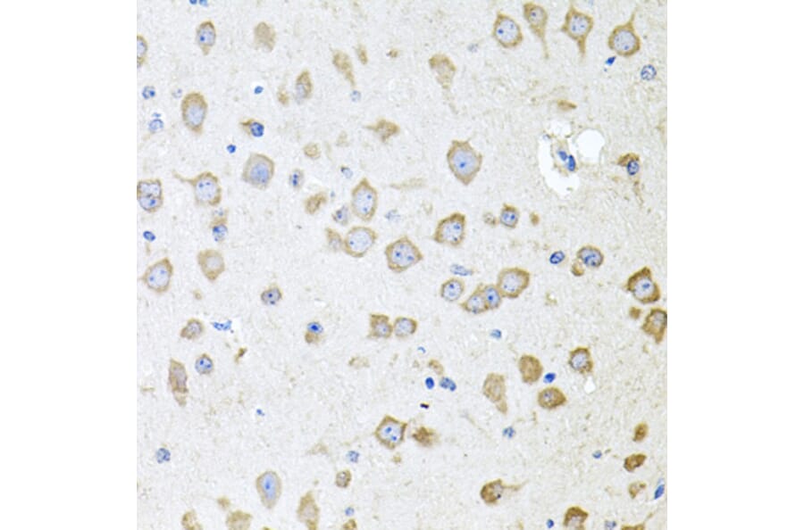 Immunohistochemistry - Anti-AKAP5 Antibody (A15259) - Antibodies.com