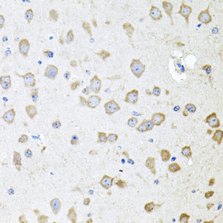 Immunohistochemistry - Anti-AKAP5 Antibody (A15259) - Antibodies.com