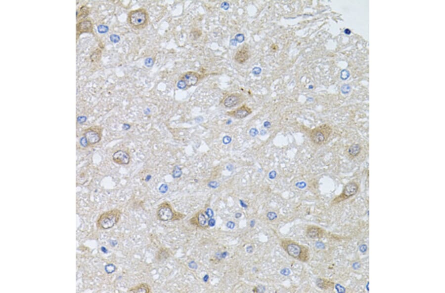 Immunohistochemistry - Anti-AKAP5 Antibody (A15259) - Antibodies.com