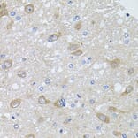 Immunohistochemistry - Anti-AKAP5 Antibody (A15259) - Antibodies.com