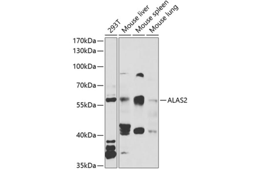 Western Blot - Anti-ALAS2/ASB Antibody (A15260) - Antibodies.com
