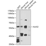 Western Blot - Anti-ALAS2/ASB Antibody (A15260) - Antibodies.com