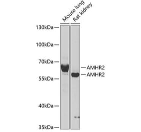 Western Blot - Anti-AMHR2 Antibody (A15261) - Antibodies.com