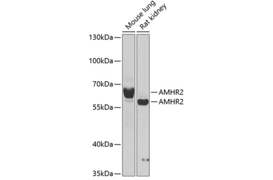Western Blot - Anti-AMHR2 Antibody (A15261) - Antibodies.com