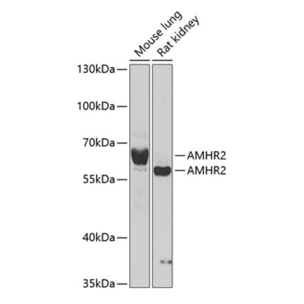 Western Blot - Anti-AMHR2 Antibody (A15261) - Antibodies.com