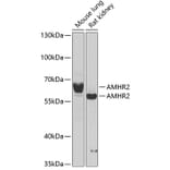 Western Blot - Anti-AMHR2 Antibody (A15261) - Antibodies.com